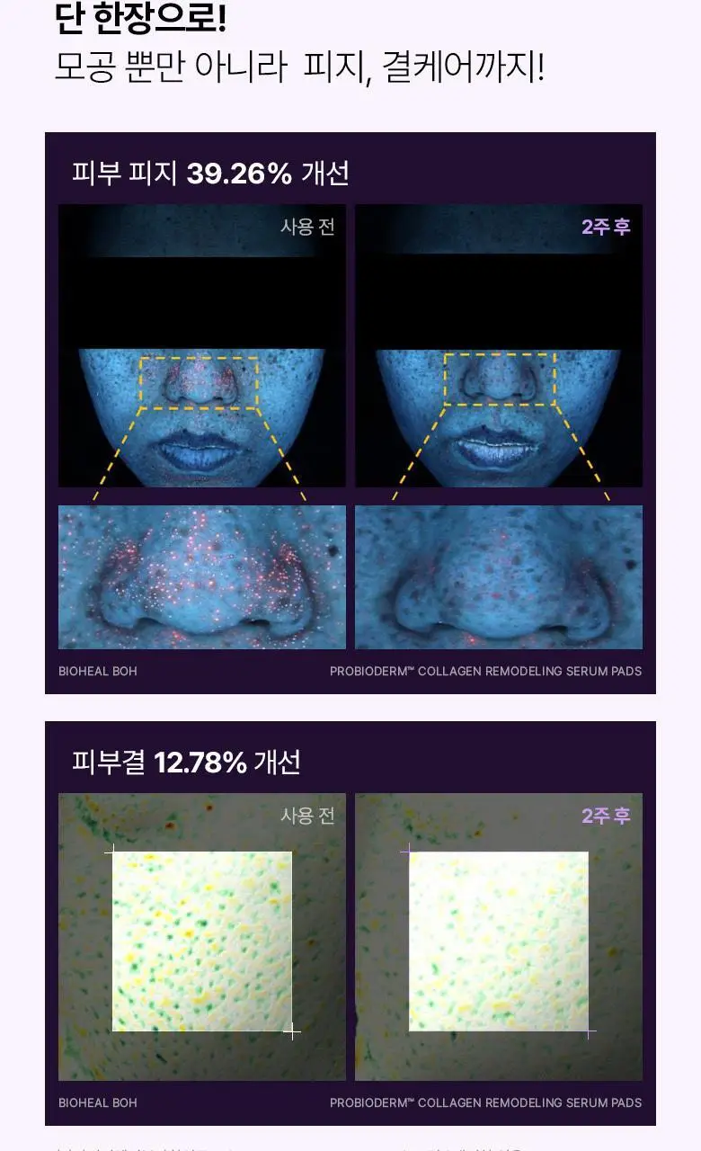 [모공고민|닦팩토듀얼] 바이오힐보 프로바이오덤 콜라겐 리모델링 세럼 패드 70매 상세페이지 15